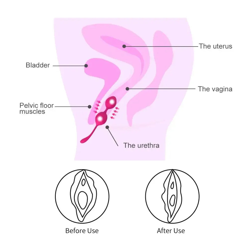 Silicone Kegel Balls For Vaginal Tightening And Pleasure